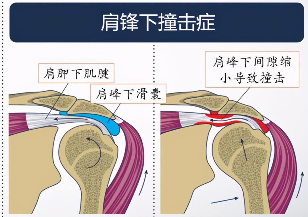 关节健身操_关节健身操视频_健身 关节